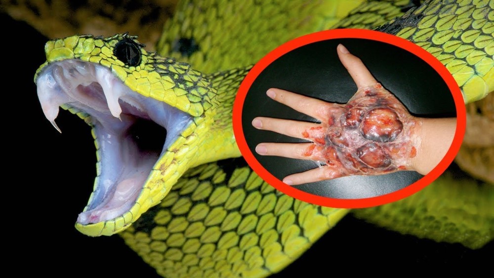 How to Tell if a Snake is Poisonous based on Looks, Sounds and More
