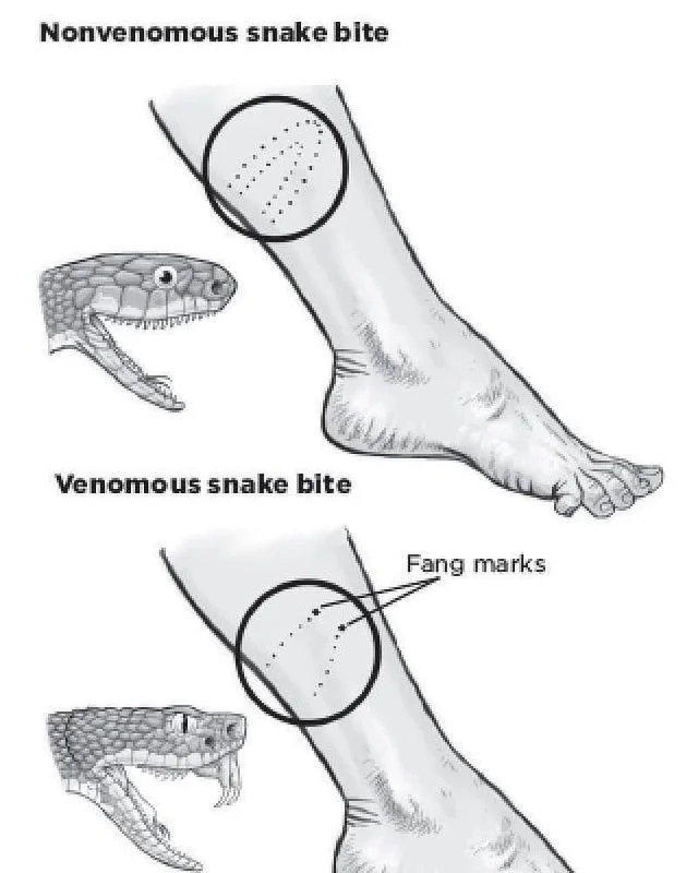What are the signs of a venomous snake bite?